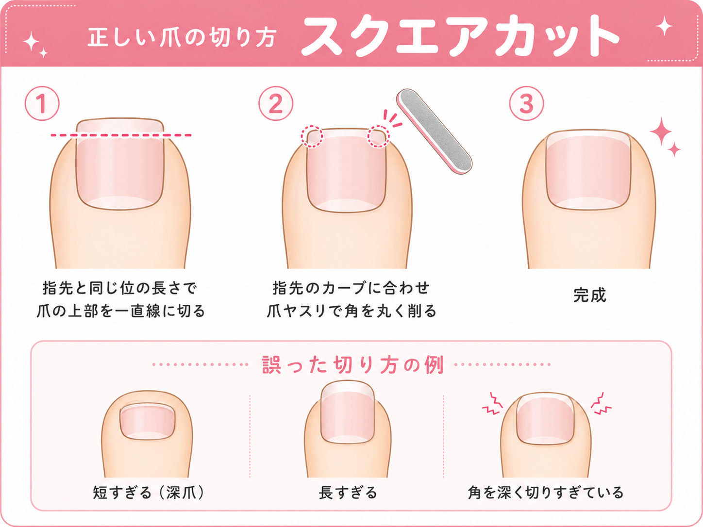 正しい爪の切り方(スクエアカット)の図解